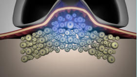 LipoContrast